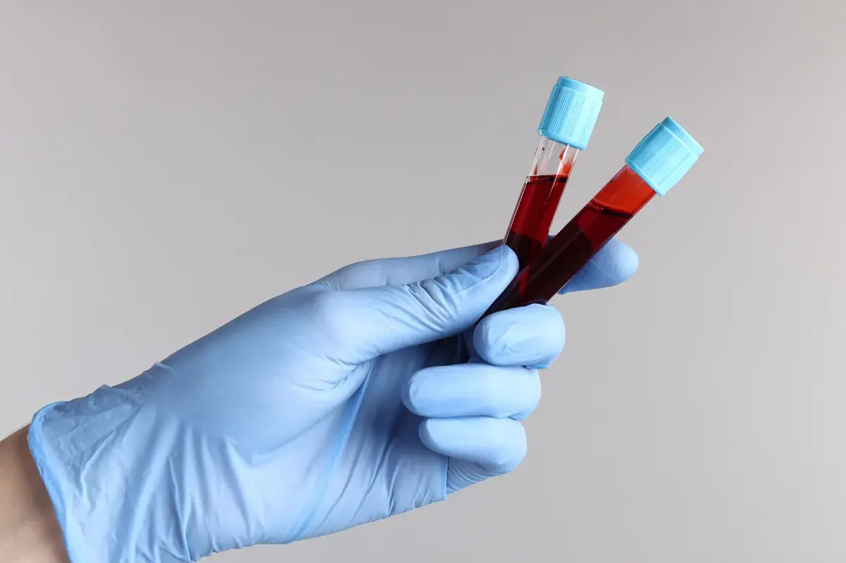 Gloved hand holding two medical vials of blood samples