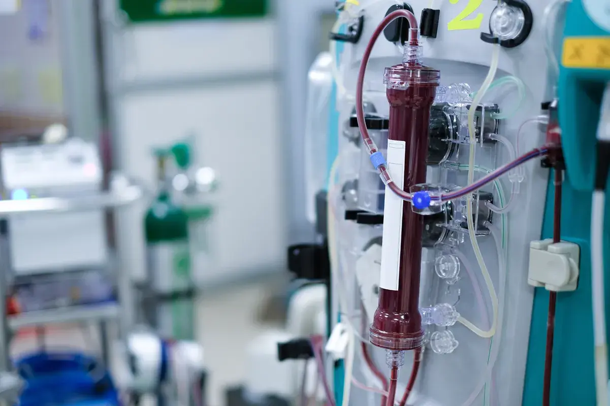 Close-up of a dialysis machine filter filled with blood