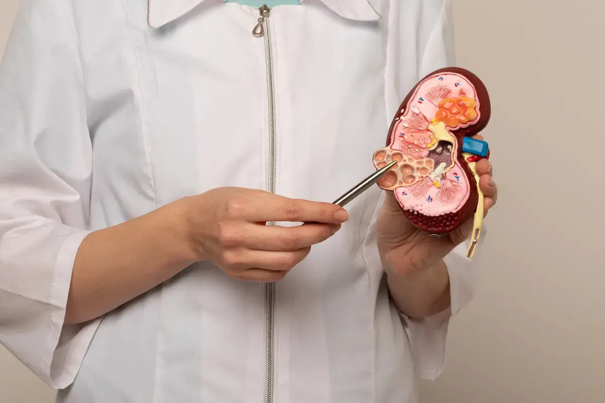 Doctor pointing to a diseased human kidney model