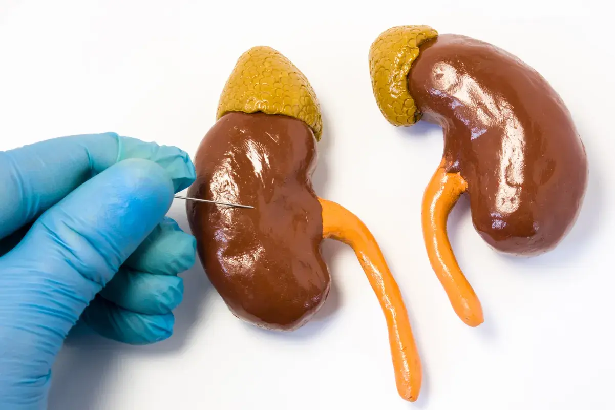 Doctor performing kidney biopsy procedure with needle