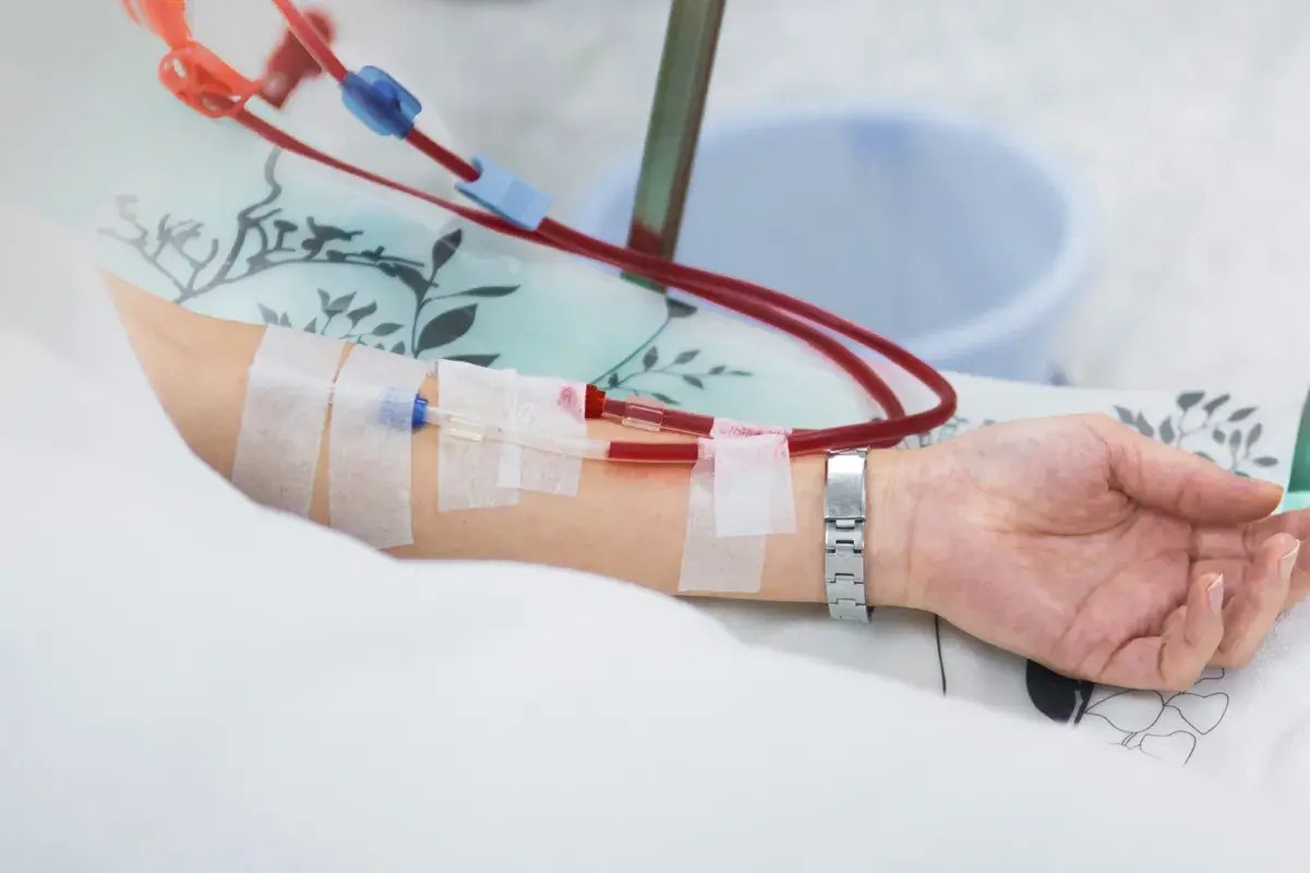 Close-up of intravenous tubes on a patient's arm