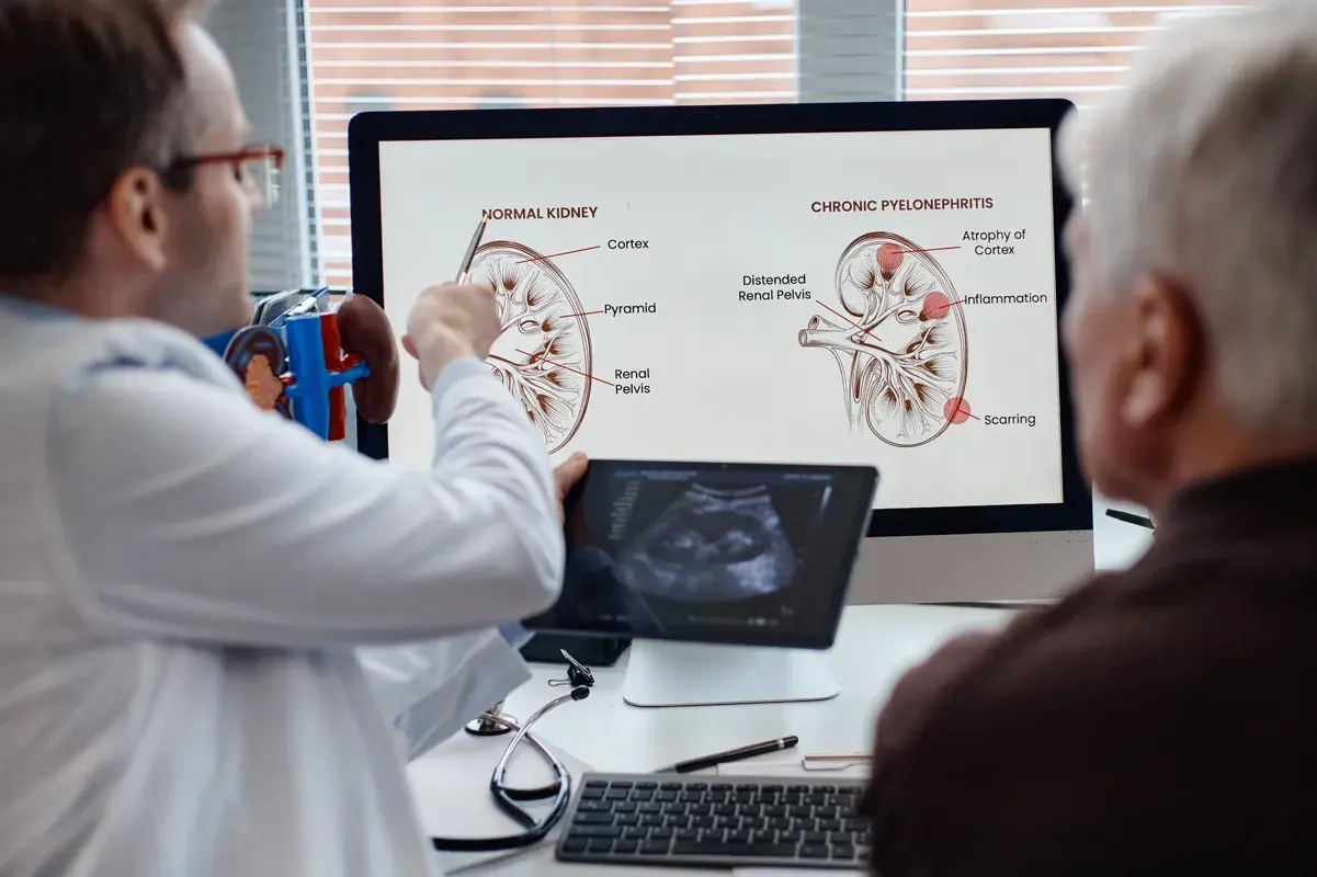 Doctor examining kidney scan images on monitor screen