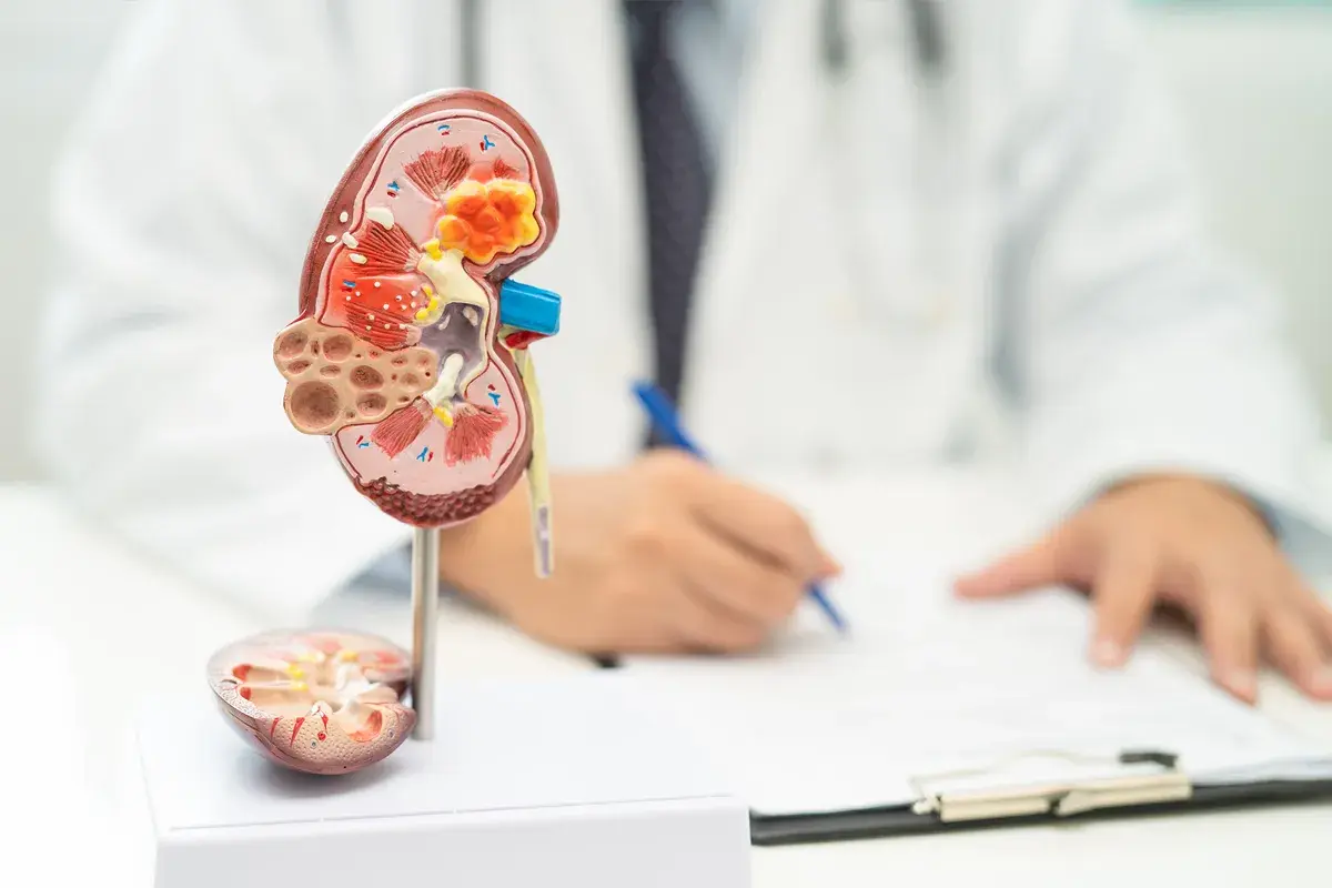 How Nephrology and Urology Differ in Kidney Care