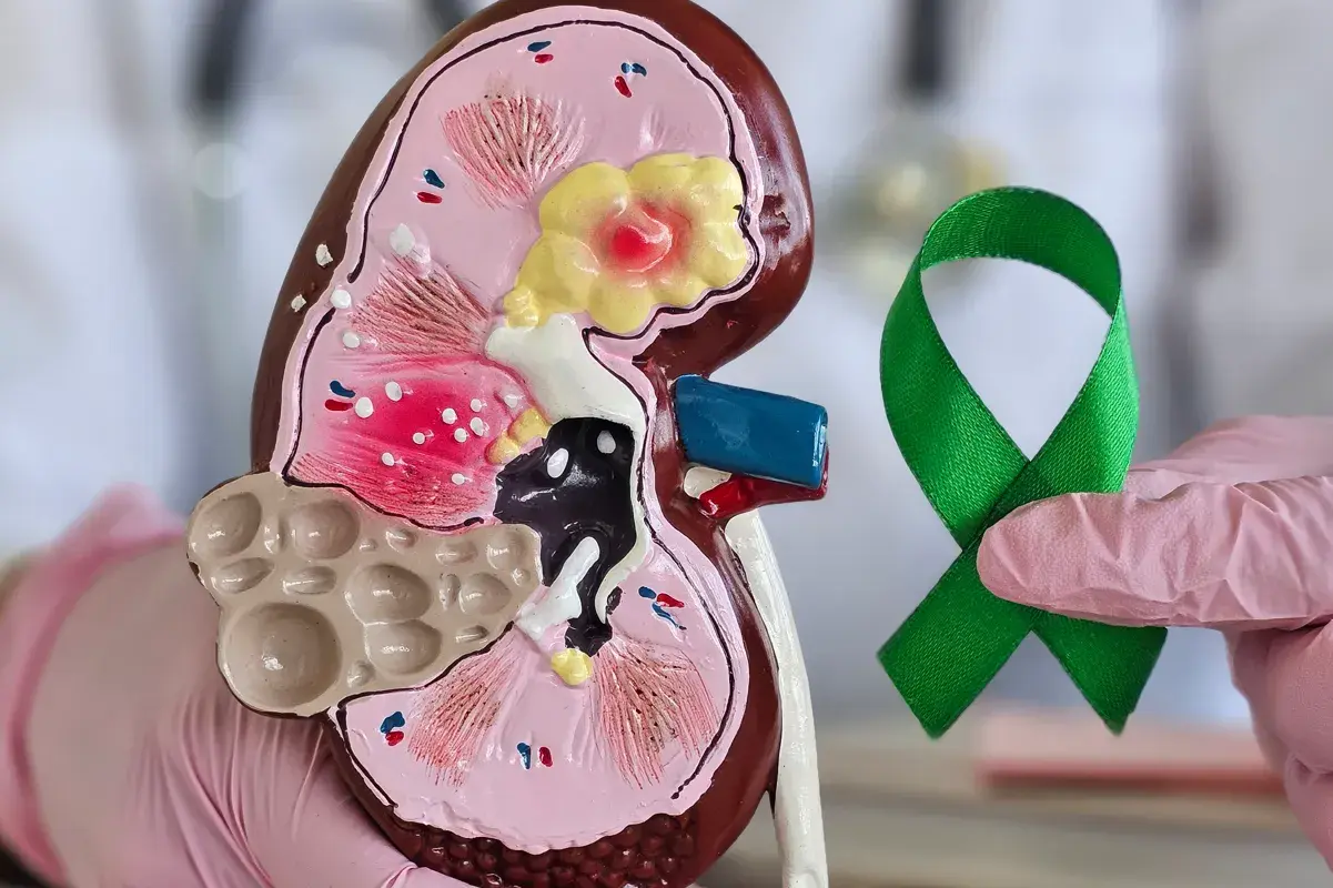 Doctor holding a diseased kidney model and green ribbon
