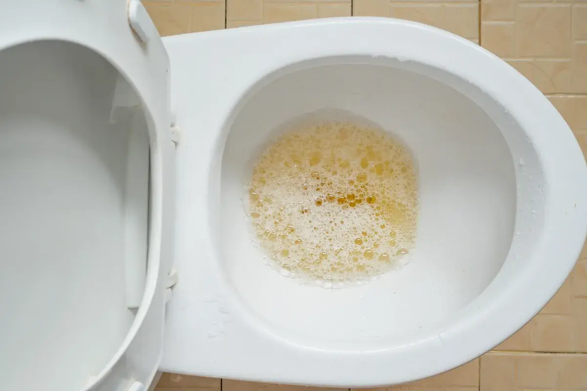 Top-down view of foamy yellow urine in a toilet