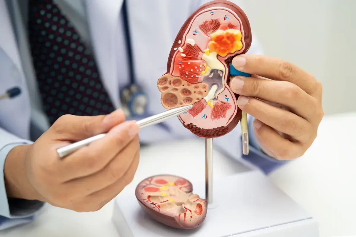Medical professional explaining renal anatomy with a kidney model.