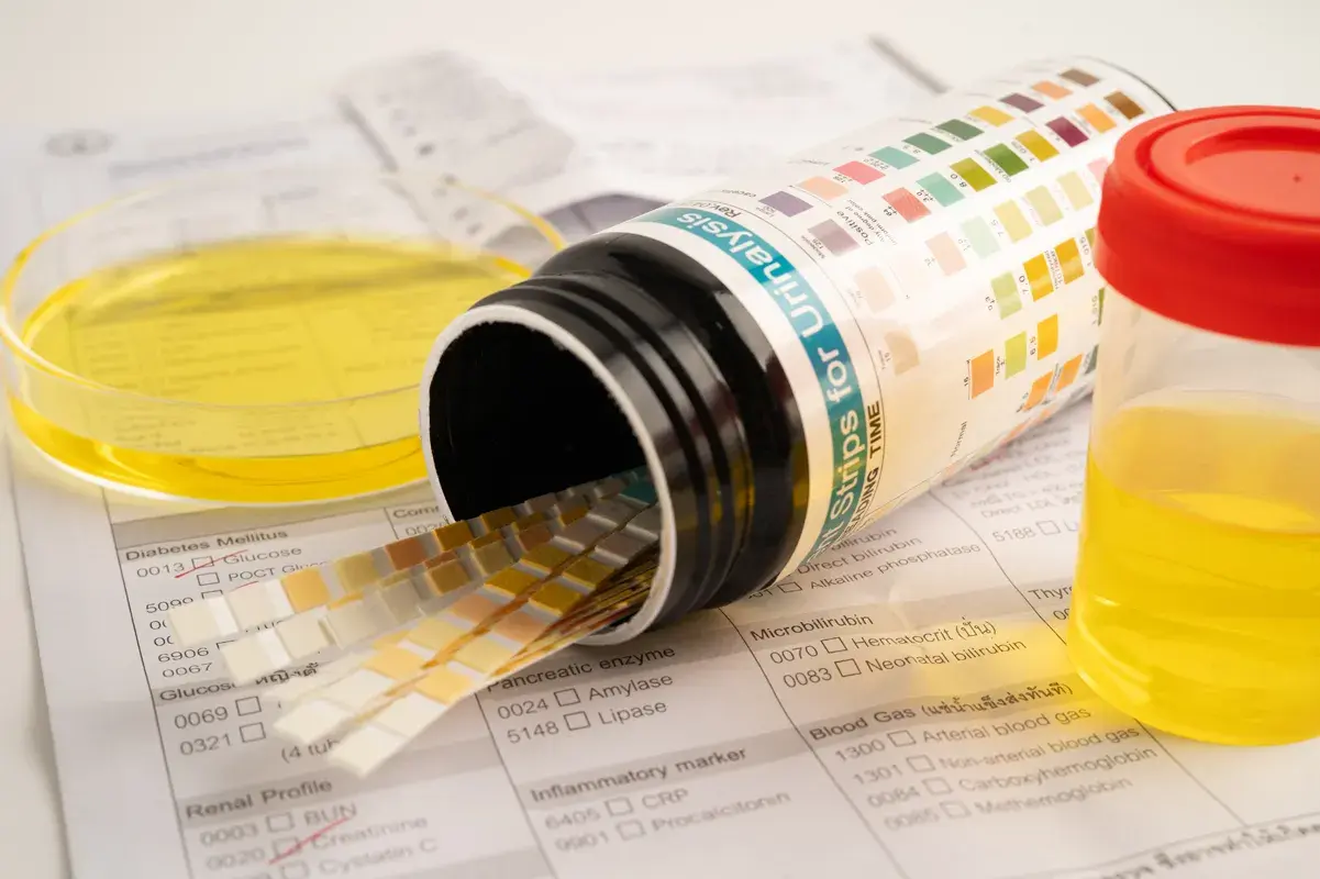 Urine sample cup lab testing strip