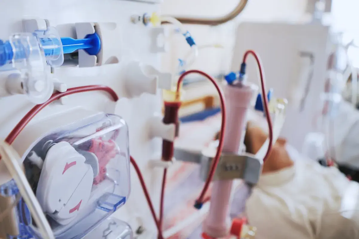 Close-up of haemodialysis machine filtering patient's blood