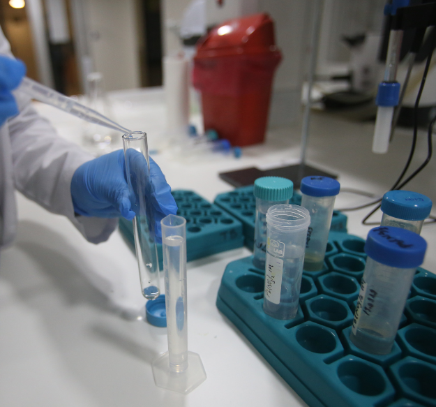 Glomerulonephritis symptoms