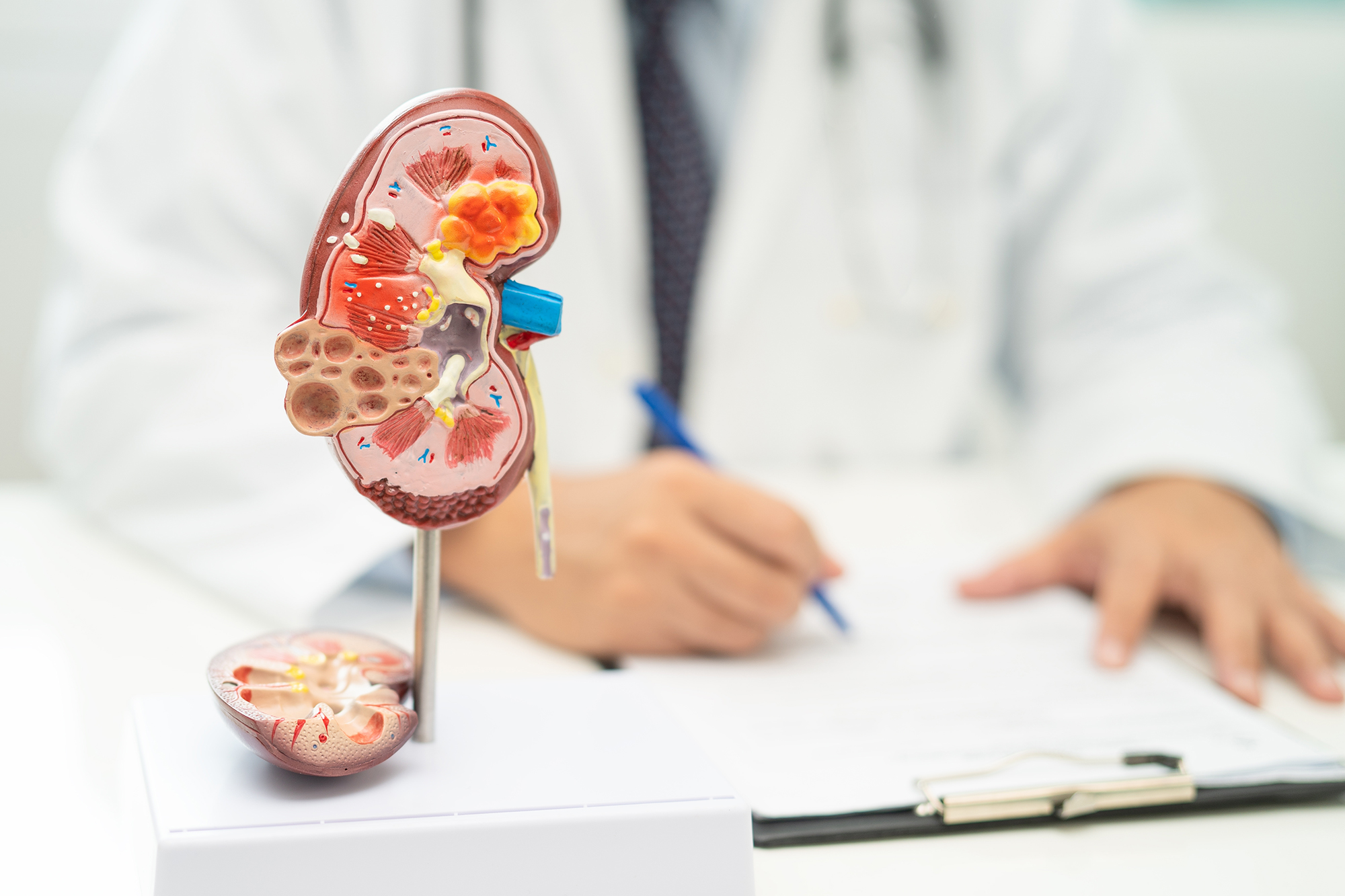 How Nephrology and Urology Differ in Kidney Care