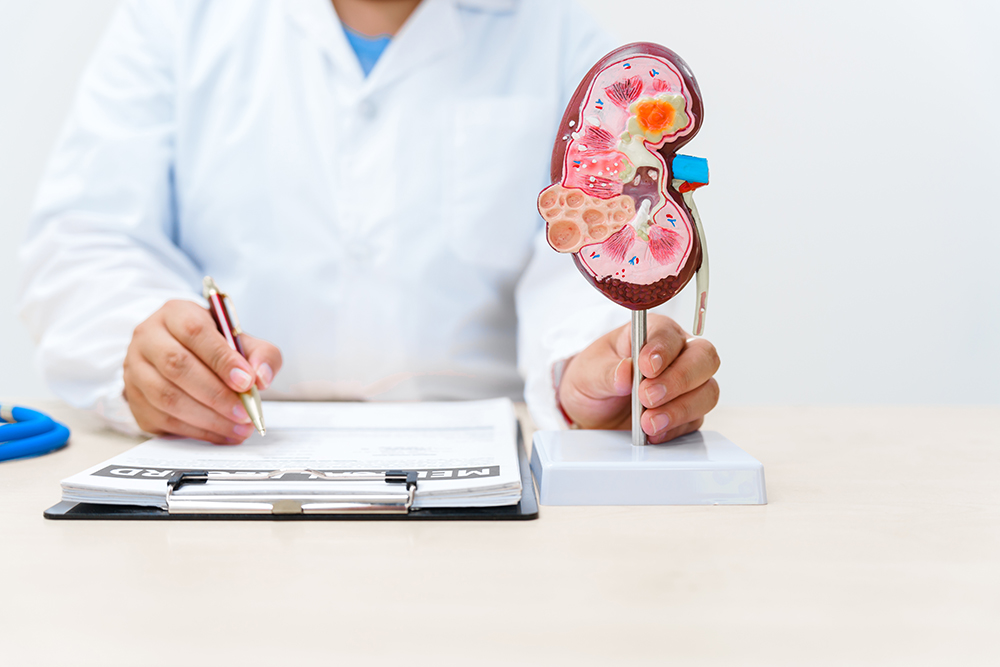An anatomical diagram of a kidney