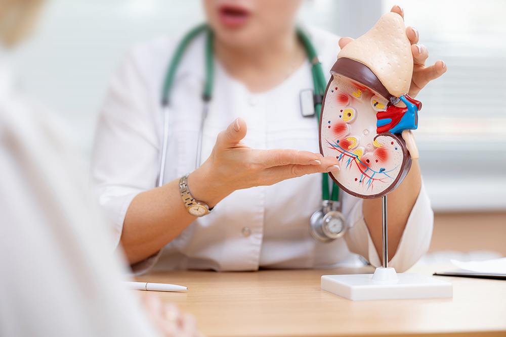 A doctor showing a patient an anatomical diagram of a kidney