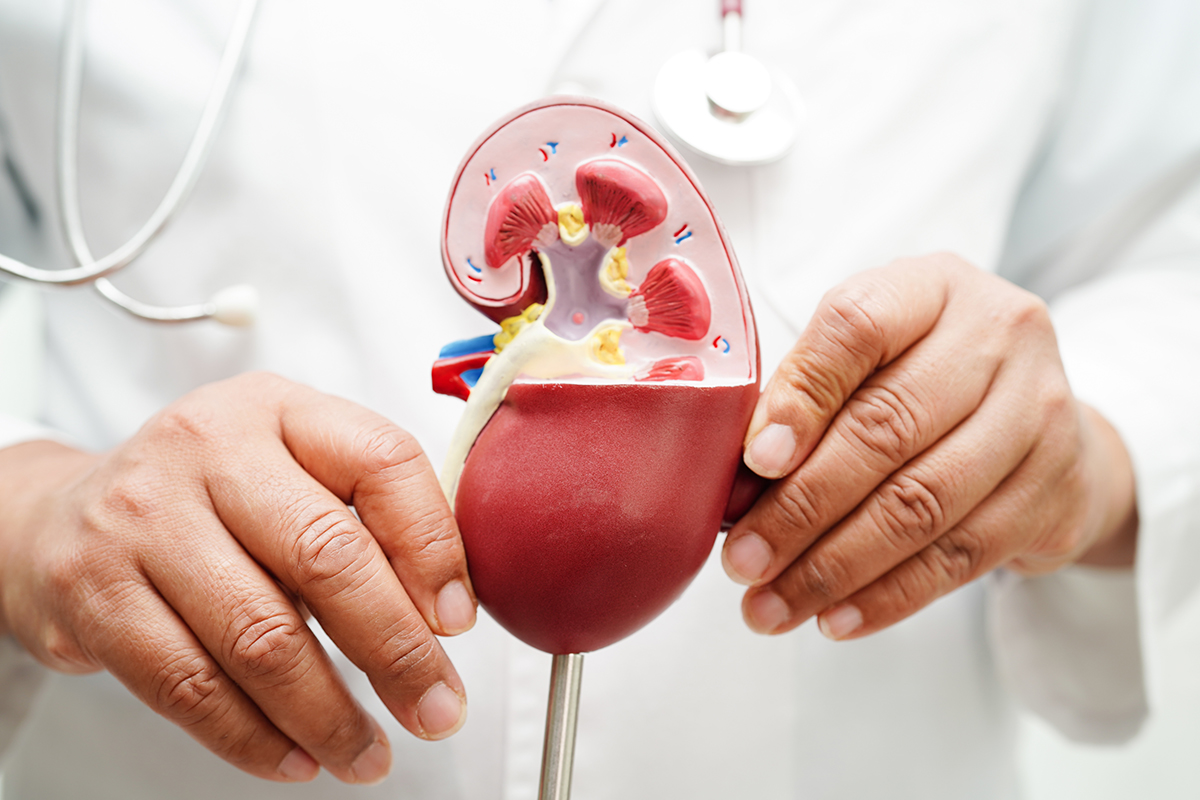 A doctor holding a model of a kidney