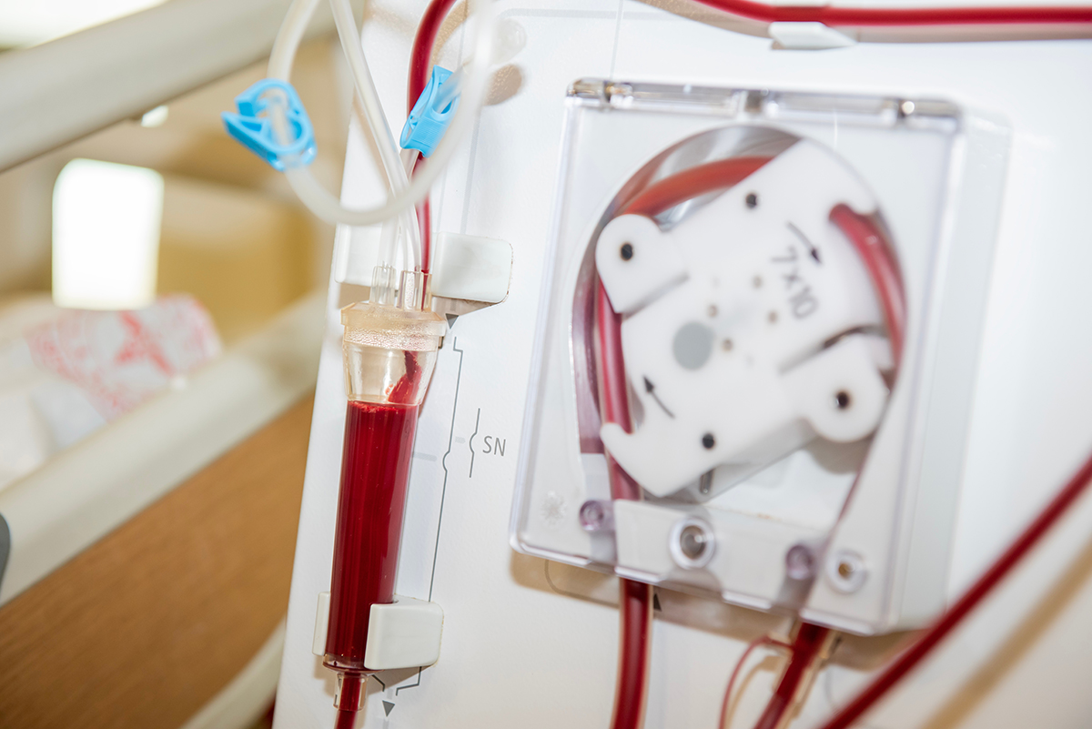 A dialysis machine